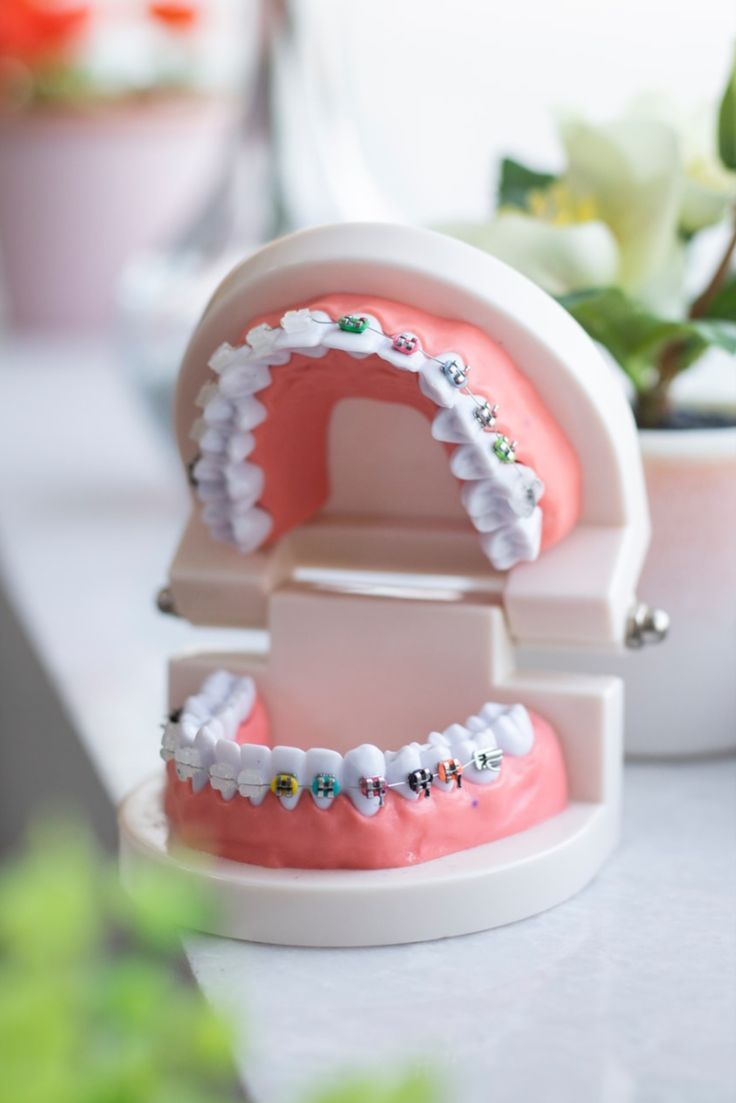 Dolor por Ajuste de Brackets Duración y Alivio con la Dra. Mayra Moreno