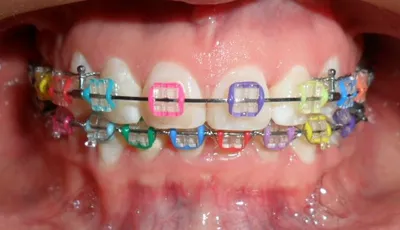 Logo de Ortodoncia Cuernavaca, clínica especialista en brackets dirigida por la Dra. Mayra Moreno.