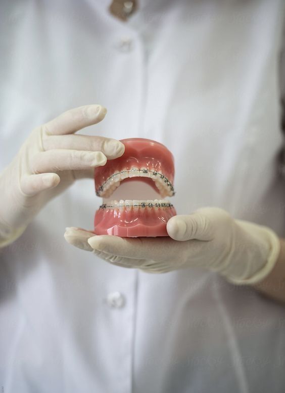 ¿Qué es la Ortodoncia? Guía Completa con Beneficios y Tipos